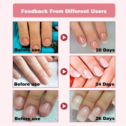 Nail Strengthener Gel & Growth Restorer