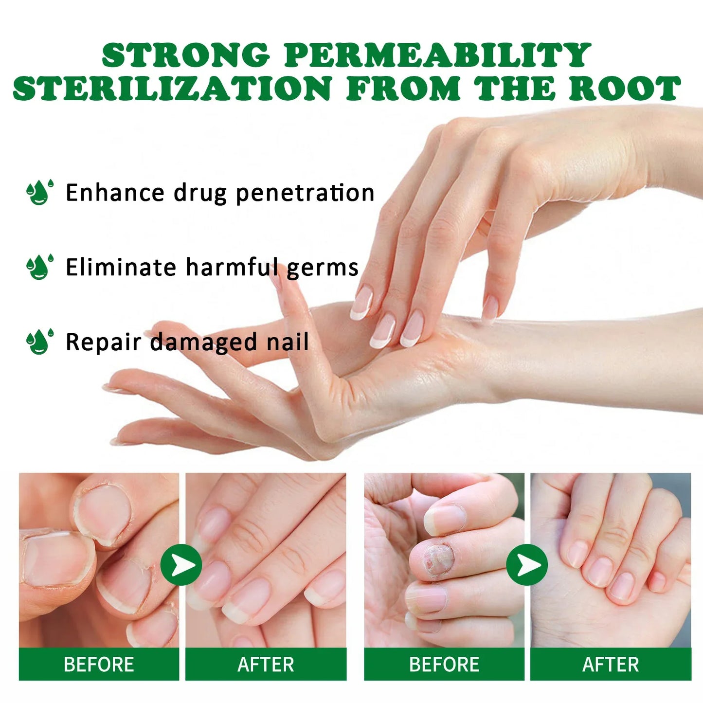 Nail Fungal Treatment Serum