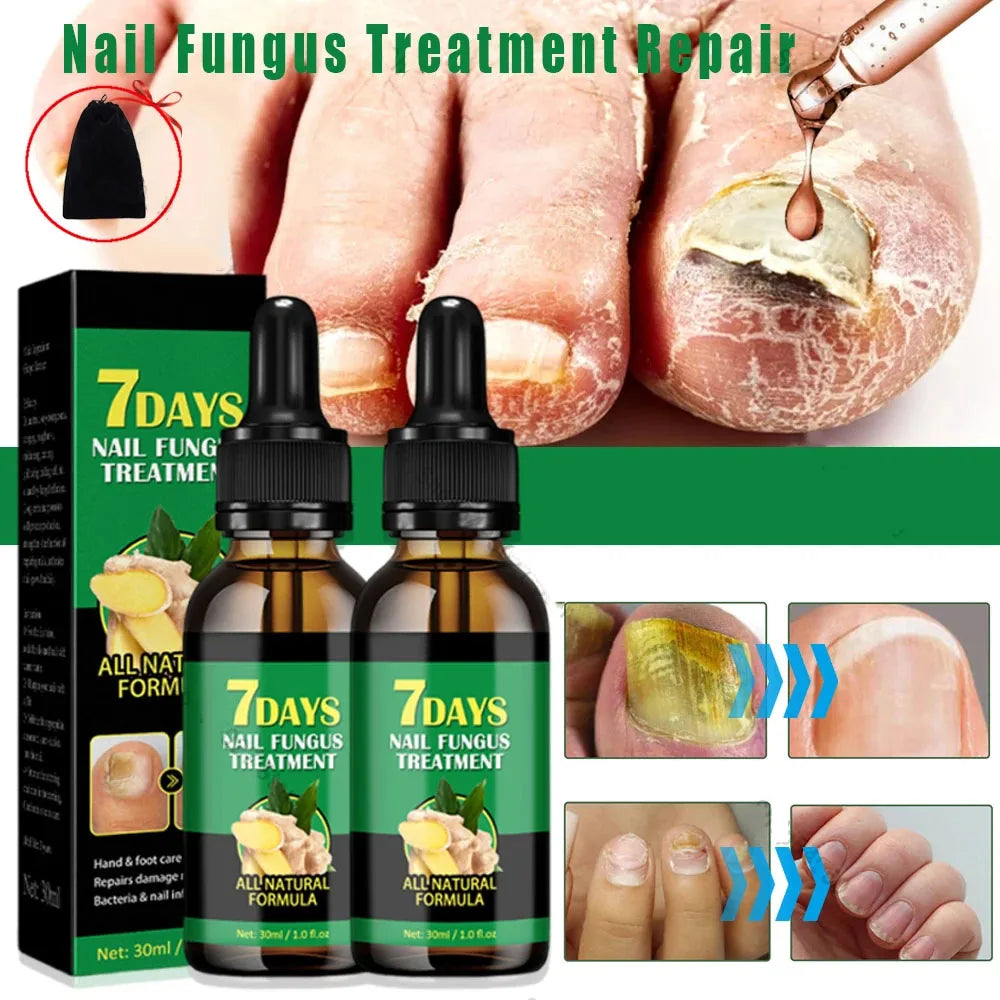 Nail Fungal Treatment Serum