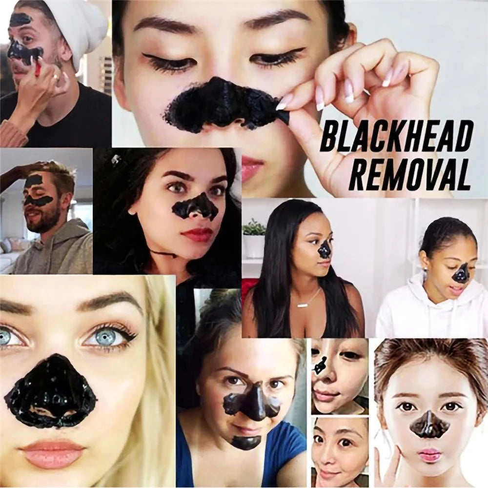 Dead Sea Mud Blackhead Remover Mask